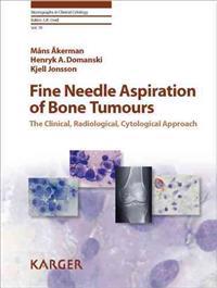 Fine-Needle Aspiration of Bone Tumors