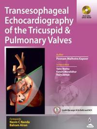 Transesophageal Echocardiography of the Tricuspid and Pulmonary Valves