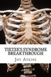 Tietze's Syndrome Breakthrough