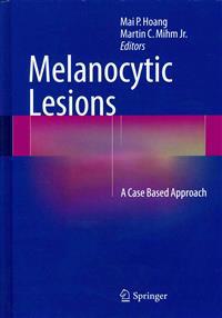 Melanocytic Lesions