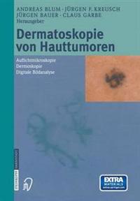 Dermatoskopie Von Hauttumoren