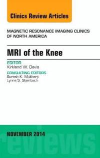 MRI of the Knee