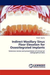 Indirect Maxillary Sinus Floor Elevation for Osseoitegrated Implants