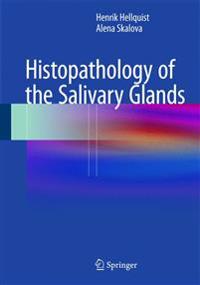 Histopathology of the Salivary Glands
