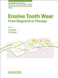 Erosive Tooth Wear