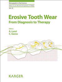Erosive Tooth Wear