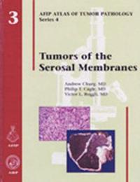 Tumors of Serosal Membranes