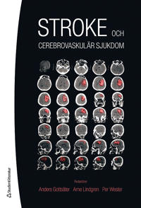 Stroke : och cerebrovaskulär sjukdom