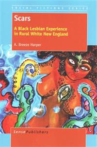 Scars: A Black Lesbian Experience in Rural White New England