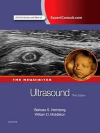 Ultrasound