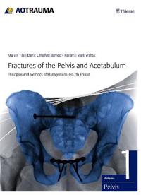 Fractures of the Pelvis and Acetabulum