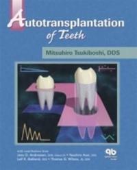 Autotransplantation of Teeth