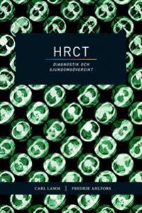 HRCT - diagnostik och sjukdomsöversikt