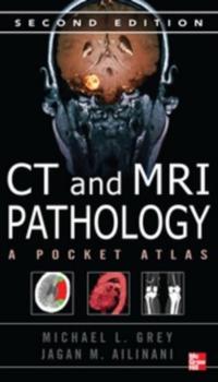 CT & MRI Pathology: A Pocket Atlas, Second Edition