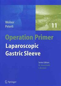 Laparoscopic Gastric Sleeve