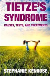 Tietze's Syndrome: Causes, Tests, and Treatments