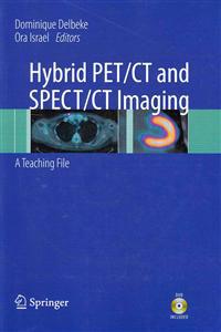 Hybrid PET/CT and SPECT/CT Imaging