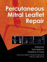 Percutaneous Mitral Leaflet Repair