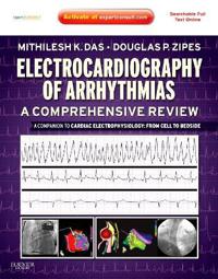 Electrocardiography of Arrhythmias