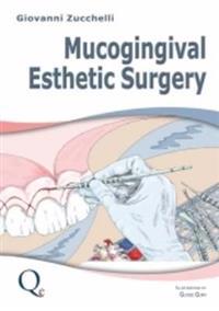 Mucogingival Esthetic Surgery