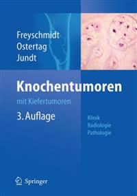 Knochentumoren Mit Kiefertumoren: Klinik - Radiologie - Pathologie