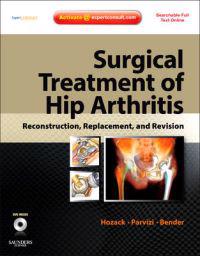 Surgical Treatment of Hip Arthritis