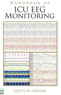 Handbook of ICU EEG Monitoring