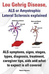 Lou Gehrig Disease, ALS or Amyotrophic Lateral Sclerosis explained. ALS symptoms, signs, stages, types, diagnosis, treatment, caregiver tips, aids and what to expect all covered.