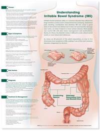 Understanding Irritable Bowel Syndrome (IBS)