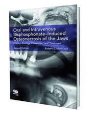 Oral and Intravenous Bisphosphonate-Induced Osteonecrosis of the Jaws