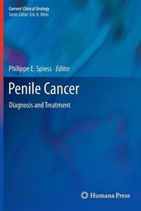 Penile Cancer