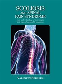 Scoliosis and Spinal Pain Syndrome
