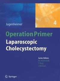 Laparoscopic Cholecystectomy