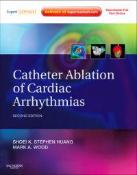 Catheter Ablation of Cardiac Arrhythmias