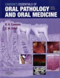 Cawson's Essentials of Oral Pathology and Oral Medicine