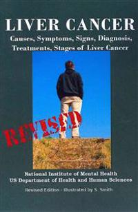 Liver Cancer: Causes, Symptoms, Signs, Diagnosis, Treatments, Stages of Liver Cancer - Revised Edition - Illustrated by S. Smith