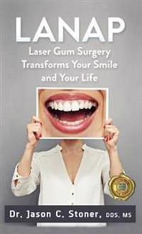 Lanap Laser Gum Surgery