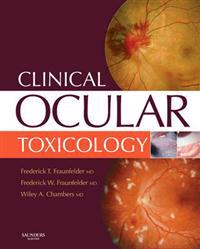 Clinical Ocular Toxicology