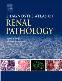 Diagnostic Atlas of Renal Pathology: A Companion to Brenner and Rector's the Kidney 7e