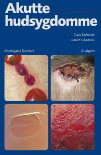 Akutte hudsygdomme