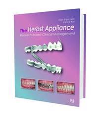 The Herbst Appliance