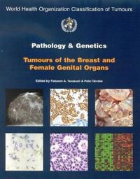 Pathology And Genetics of Tumours of the Breast & Female Genital Organs