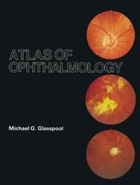 Atlas of Ophthalmology