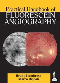 Practical Handbook of Fluorescein Angiography