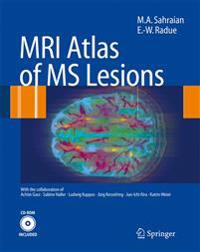 MRI Atlas of MS Lesions
