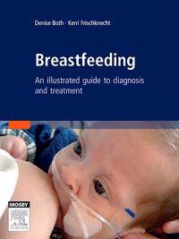 Breastfeeding