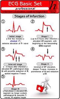 ECG Basic Set, Professional: Localization, Leads & Diagnostics, ECG Analysis Instructions, Cardiac Arrhythmia, ECG Ruler