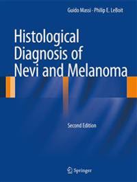 Histological Diagnosis of Nevi and Melanoma