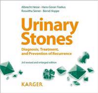 Urinary Stones