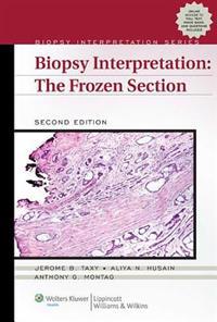 Biopsy Interpretation: The Frozen Section